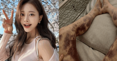 YouTuber Aori wins defamation lawsuit against Gangnam clinic after skin treatment controversy