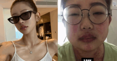 Korean star opens up about lupus recovery and dramatic weight loss success