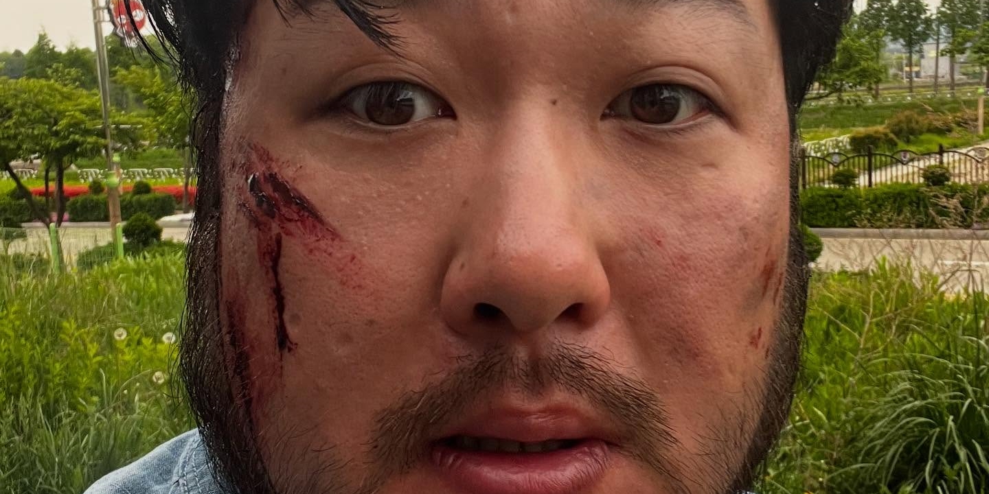 Kim Dae-ho hospitalized for malaria treatment, highlighting his health battle