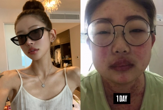 Korean actress daughter Choi Joonhee reveals her transformation after losing 55kg
