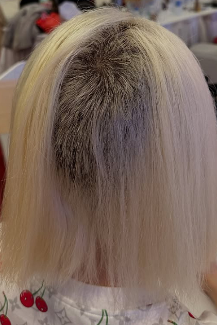 The shocking hair mishap of DJ Soda and her journey to recovery